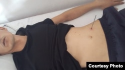 A picture has circulated on social media showing a man identified as Uzynzhasov with what appears to be his abdomen punctured with a metal stick.
